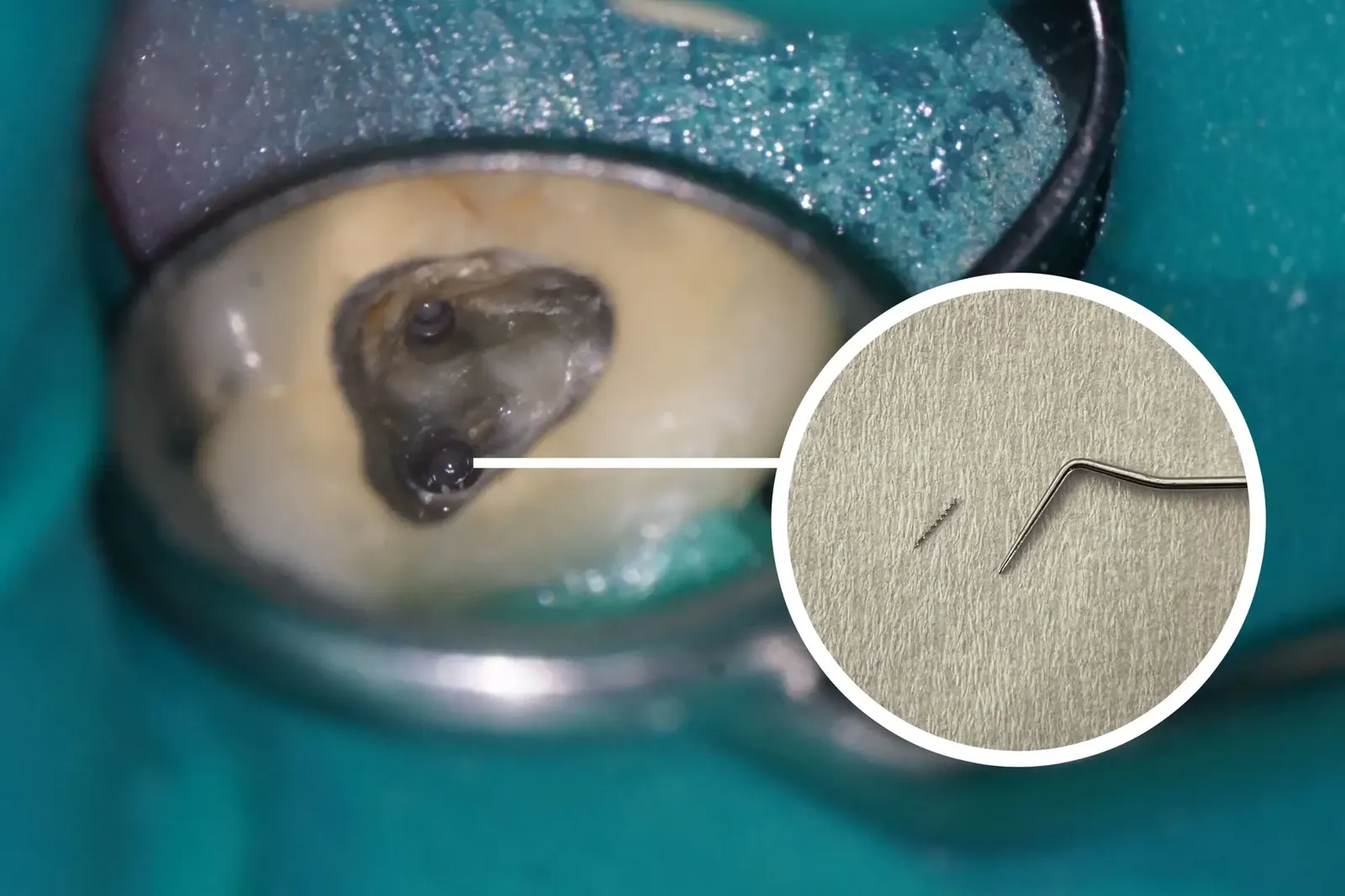 OP-Mikroskop für präzise Endodontie