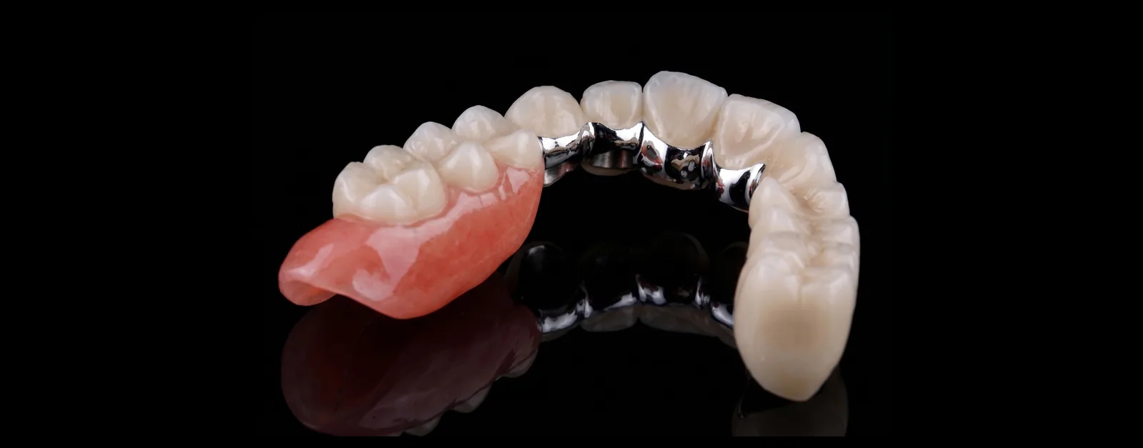 Herausnehmbarer Zahnersatz